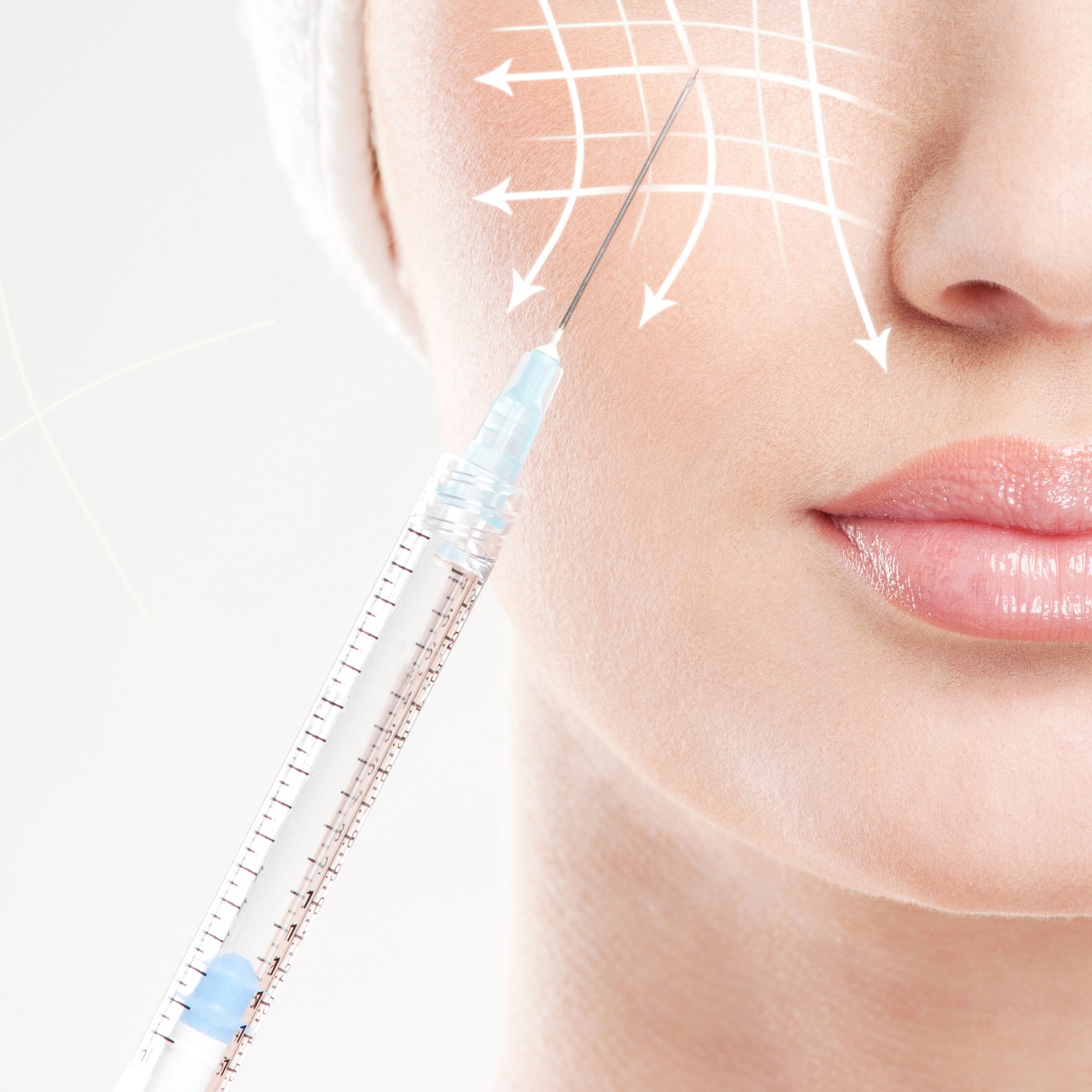 Botox: Entenda tudo sobre este tratamento maravilhoso